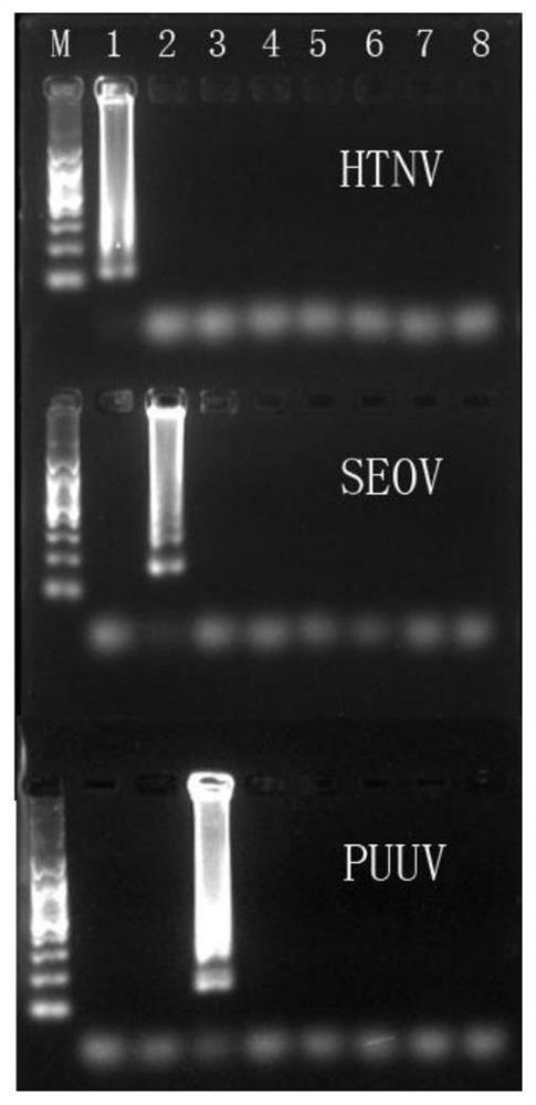 用于检测汉坦病毒的检测引物、检测试剂盒及检测方法