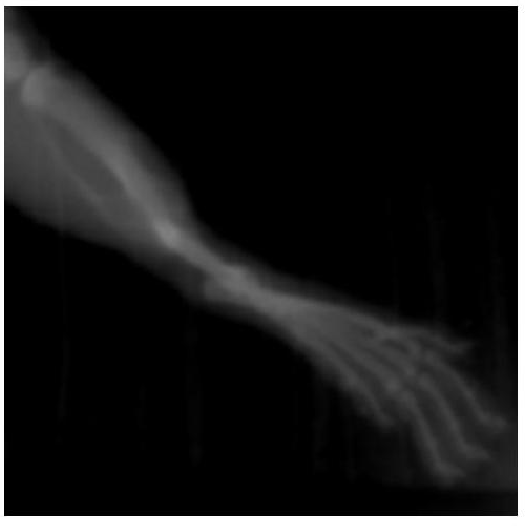 一种治疗骨折的中药贴膏剂及其制备方法