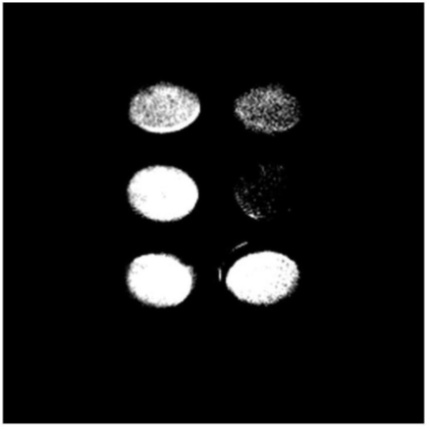 一种稀土微纳米材料与甲壳素复合骨植入材料及制备方法